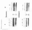 Fig. 07 - Methods of treating eye diseases in diabetic patients
