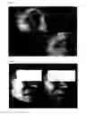 Fig. 04 - Agent for Treating Skin Aging and Scars