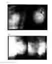 Fig. 06 - Agent for Treating Skin Aging and Scars