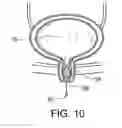 Fig. 11 - Urinary incontinence device