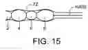 Fig. 16 - Urinary incontinence device