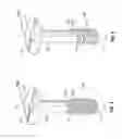 Fig. 03 - SURGICAL PORTAL DEVICE INCLUDING TEXTURED SURFACE