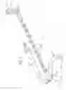 Fig. 03 - Intracardiac sheath stabilizer