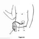 Fig. 08 - METHOD AND DEVICE FOR NON-INVASIVE DETERMINATION OF THE CONCENTRATION OF A SUBSTANCE IN A BODY FLUID
