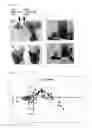 Fig. 02 - METHOD AND APPARATUS FOR EXAMINATION OF CANCER, SYSTEMIC LUPUS ERYTHEMATOSUS (SLE), OR ANTIPHOSPHOLIPID ANTIBODY SYNDROME USING NEAR-INFRARED LIGHT