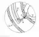 Fig. 01 - Methods and apparatuses for endoscopic retrograde cholangiopancreatography