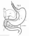 Fig. 03 - Methods and apparatuses for endoscopic retrograde cholangiopancreatography