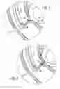 Fig. 04 - Methods and apparatuses for endoscopic retrograde cholangiopancreatography