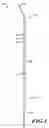Fig. 02 - Uterine sound device