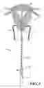 Fig. 03 - Uterine sound device