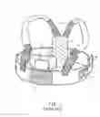 Fig. 02 - EXPANSIBLE DEVICE OF MEDICAL USE FOR SPECIFIC COMPRESSION OF THORAX, SYSTEM COMPRISING IT AND METHOD FOR CORRECTING A THORACIC DEFORMITY IN A PATIENT