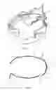 Fig. 04 - EXPANSIBLE DEVICE OF MEDICAL USE FOR SPECIFIC COMPRESSION OF THORAX, SYSTEM COMPRISING IT AND METHOD FOR CORRECTING A THORACIC DEFORMITY IN A PATIENT