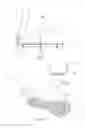 Fig. 08 - Foot abduction apparatus