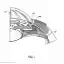 Fig. 02 - Glaucoma treatment device