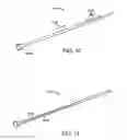 Fig. 12 - Glaucoma treatment device
