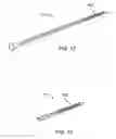 Fig. 13 - Glaucoma treatment device