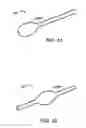 Fig. 28 - Glaucoma treatment device