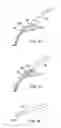 Fig. 29 - Glaucoma treatment device