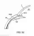 Fig. 32 - Glaucoma treatment device