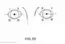 Fig. 33 - Glaucoma treatment device