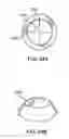Fig. 34 - Glaucoma treatment device