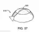Fig. 37 - Glaucoma treatment device