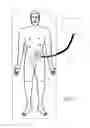 Fig. 06 - Insufflation gas warmer and humidifier