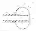 Fig. 01 - Feeding device including balloon tip and method of manufacture
