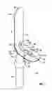 Fig. 02 - Female External Incontinence Device