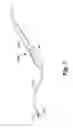 Fig. 02 - Surgical Apparatus and Method for Performing Minimally Invasive Surgery