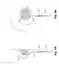 Fig. 06 - Surgical Apparatus and Method for Performing Minimally Invasive Surgery