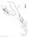 Fig. 03 - ADJUSTABLE PULMONARY VEIN ABLATION CATHETER
