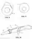 Fig. 06 - ADJUSTABLE PULMONARY VEIN ABLATION CATHETER