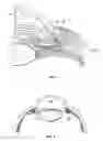 Fig. 02 - Ocular implant with stiffness qualities, methods of implantation and system