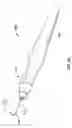 Fig. 04 - Ocular implant with stiffness qualities, methods of implantation and system