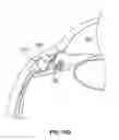 Fig. 13 - Ocular implant with stiffness qualities, methods of implantation and system