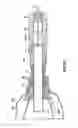 Fig. 07 - Conduit device and system for implanting a conduit device in a tissue wall
