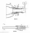 Fig. 08 - Conduit device and system for implanting a conduit device in a tissue wall