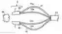 Fig. 01 - Medical retrieval device with frangible basket