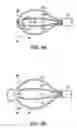Fig. 07 - Medical retrieval device with frangible basket