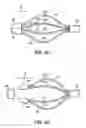 Fig. 08 - Medical retrieval device with frangible basket