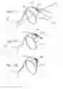 Fig. 06 - Surgical puncture cinch and closure system