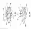 Fig. 49 - Bi-directional suture passer