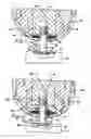 Fig. 02 - Prosthesis attachment method and apparatus with soft tissue integrating seal