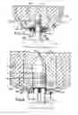 Fig. 03 - Prosthesis attachment method and apparatus with soft tissue integrating seal