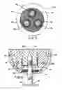 Fig. 04 - Prosthesis attachment method and apparatus with soft tissue integrating seal
