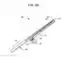 Fig. 04 - Anterior capsulotomy device and procedure