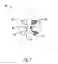 Fig. 02 - Treatment and placement device for sinusitis applications