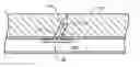 Fig. 01 - Dual hypotube suture cutting device and methods