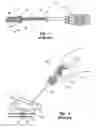 Fig. 02 - Dual hypotube suture cutting device and methods